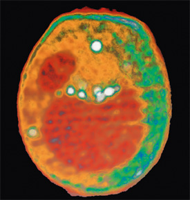 x-ray tomography image