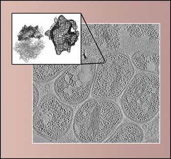 Electron tomography of biofilms