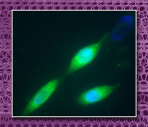 fluorescence micrograph